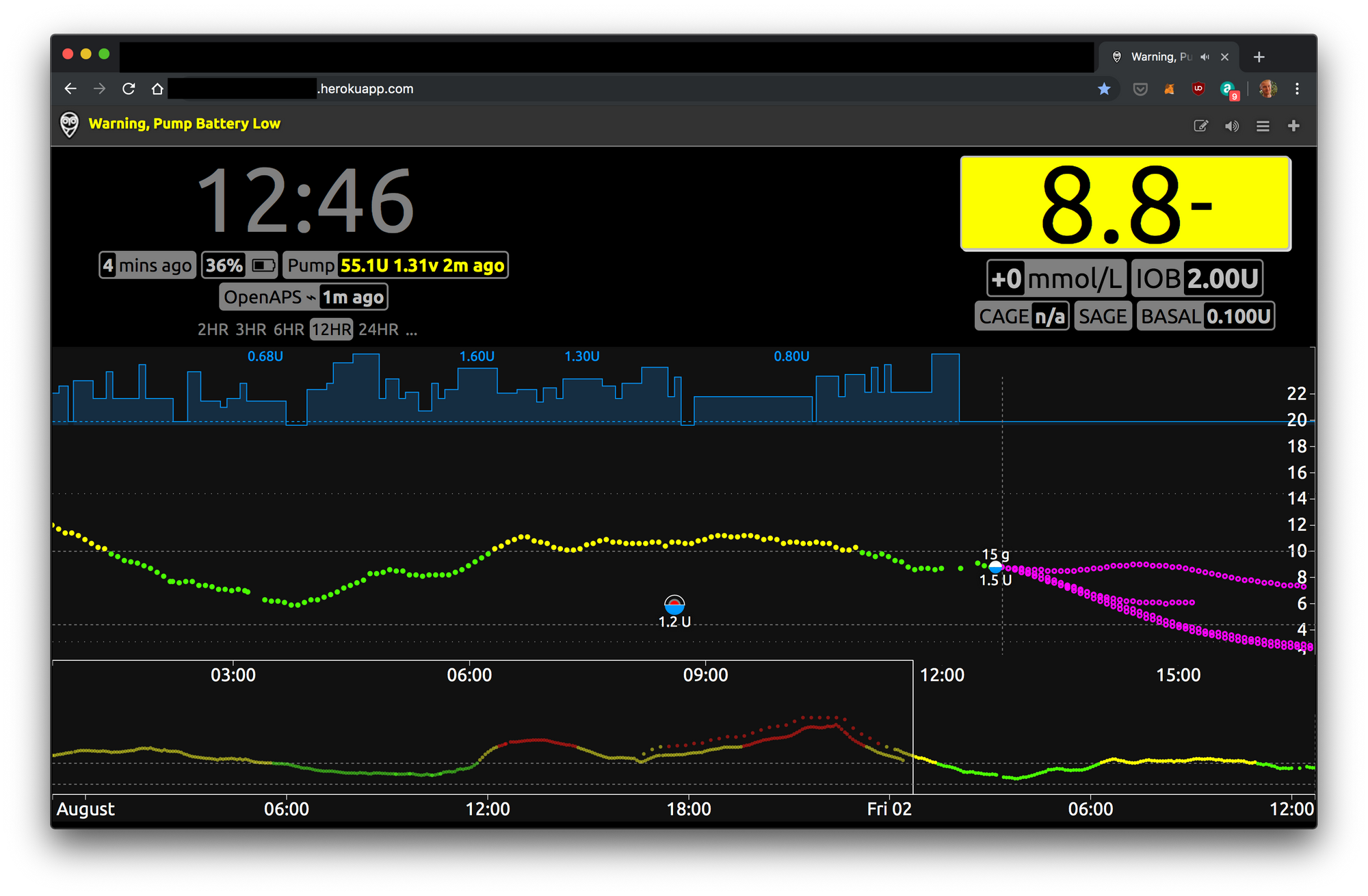 I'm a cyborg now! (On Building My Own Artificial Pancreas)