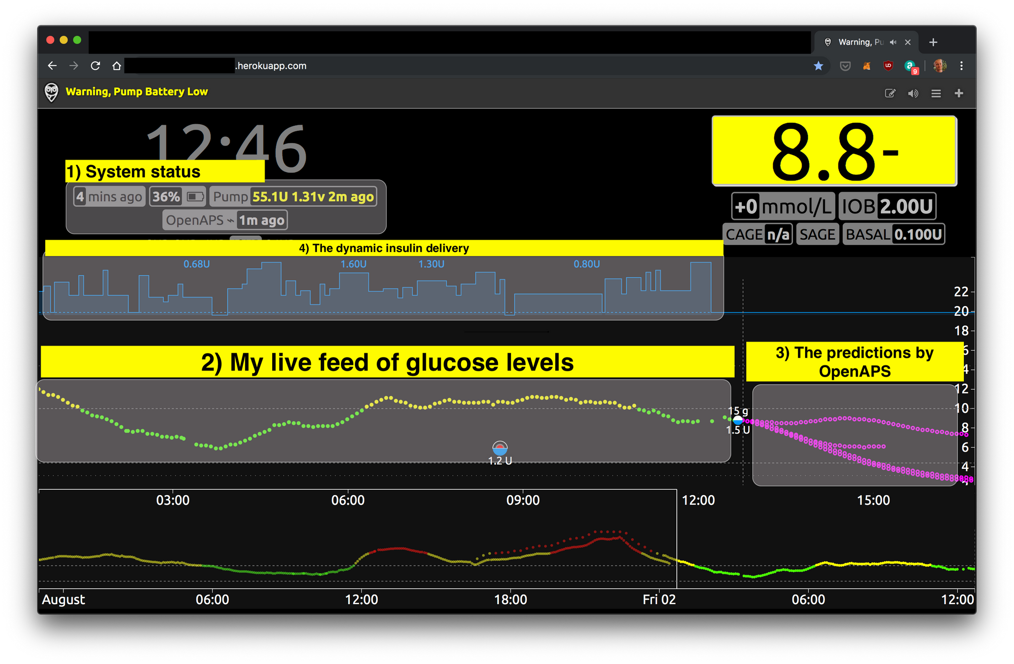 I'm a cyborg now! (On Building My Own Artificial Pancreas)